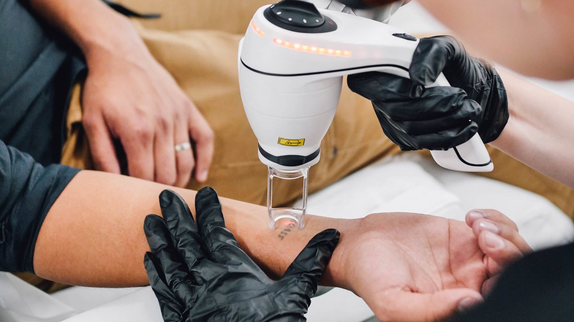LightSense™ laser therapy to remove tattoos.