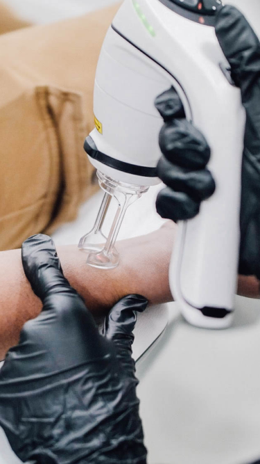 Unique laser technology used to remove tattoos.