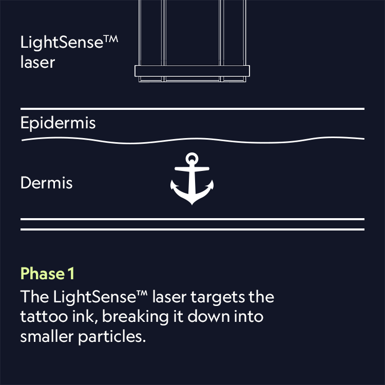 The dermis of the skin