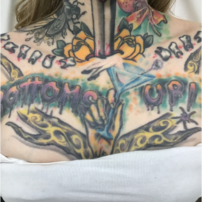 At the start of treatment